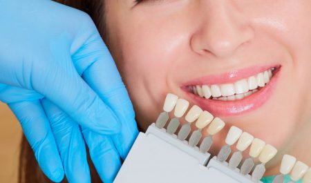 Wybielanie zębów warto zaplanować przez wszczepieniem implantów